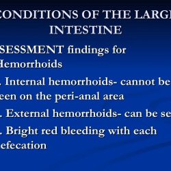 Rn learning system medical-surgical gastrointestinal practice quiz